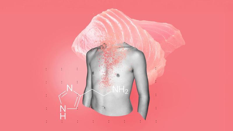 Kollaps nach dem Mittagessen: Der Burger war schuld! Kollaps nach dem Mittagessen: Der Burger war schuld!