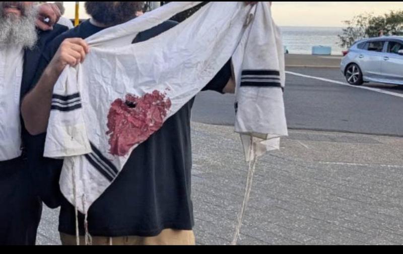 Bondi Beach, the Blame Game, and the Death of Human Empathy