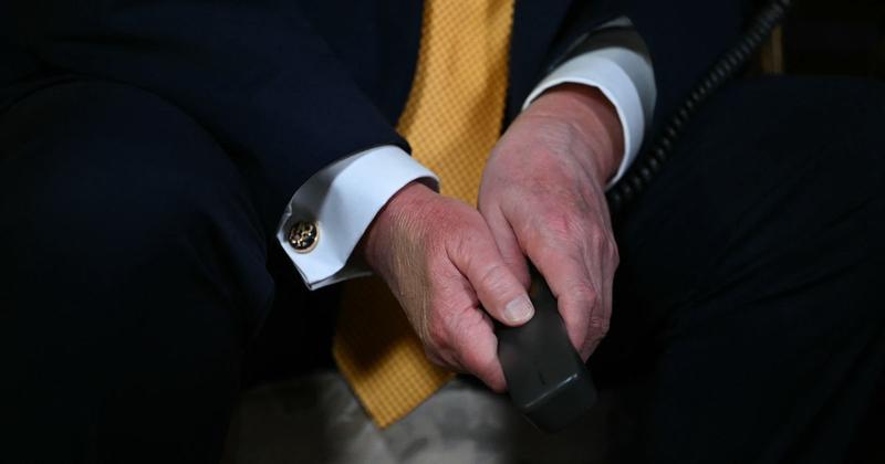 Trump’s Hand Bruise Is on the Move Trump’s Hand Bruise Is on the Move