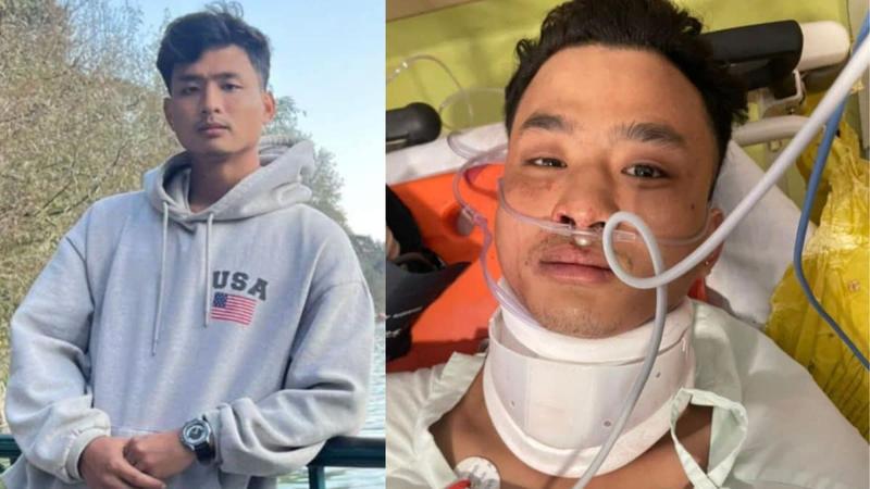 Opinion | Angel Chakma’s Death Proves Northeast Still Lives On Borders Of Indian Psyche