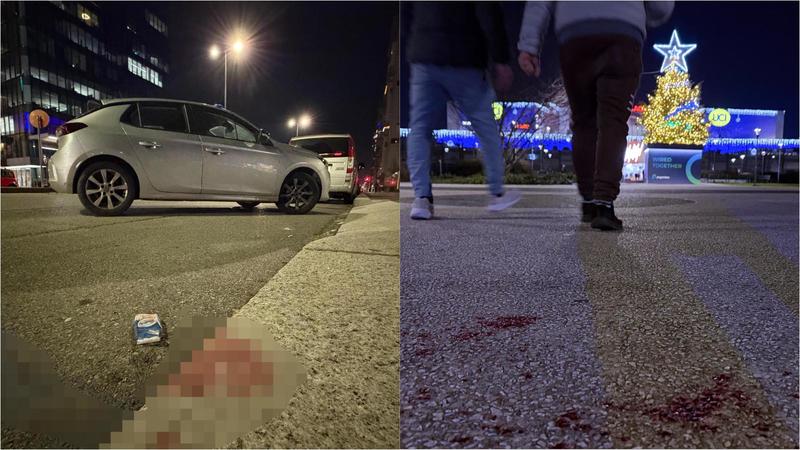 Il ragazzino di 15 anni accoltellato al Bicocca Village: squarcio al volto di 7 centimetri e una ferita al fianco. “Dammi il giubbotto”