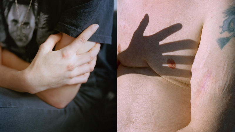 Echt jetzt, nur Frauen haben Essstörungen?