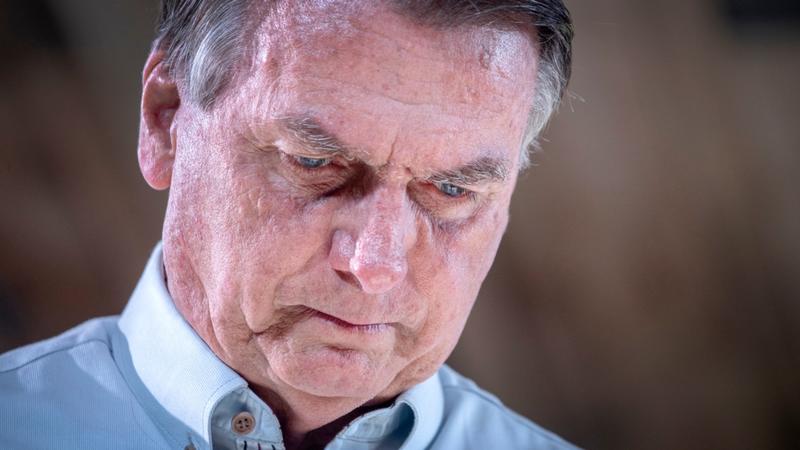 Defesa quer saber se Bolsonaro terá melhores condições na Papudinha