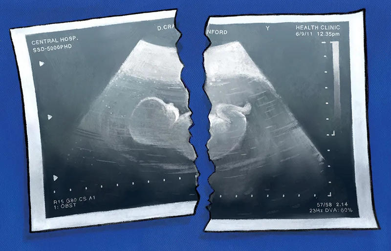 Why are the number of abortions so high?