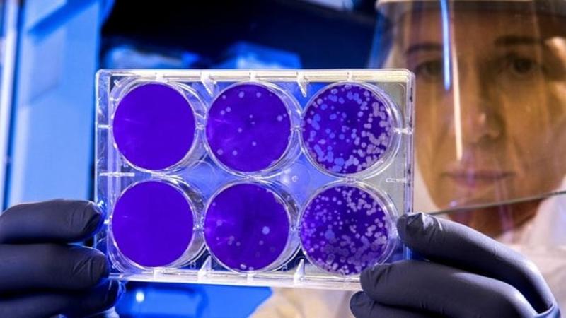 Covid, nuovo studio del Mario Negri: «L’aspirina riduce i danni ai polmoni»