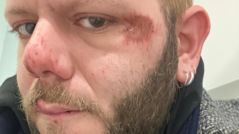 Aggressione e rapina sui viali: 