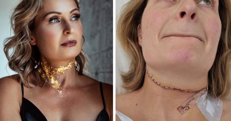 'My instinct was to run but he said he'd catch me' - Woman on horror attack by ex