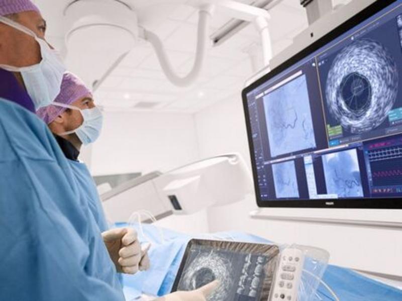 Революционен пробив: Създадоха ИИ технология, която може да предупреди за инфаркт или инсулт 12 години по-рано