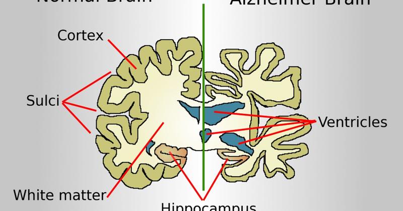 Resilience to Alzheimer's Disease
